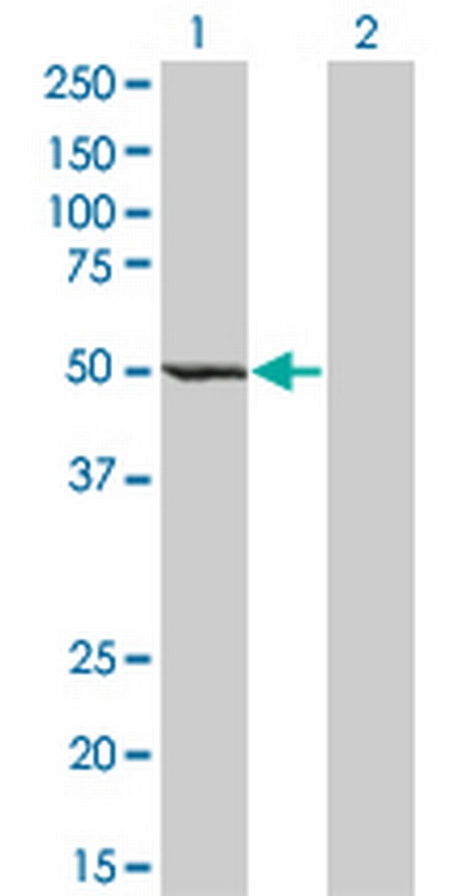 ZWILCH Antibody in Western Blot (WB)