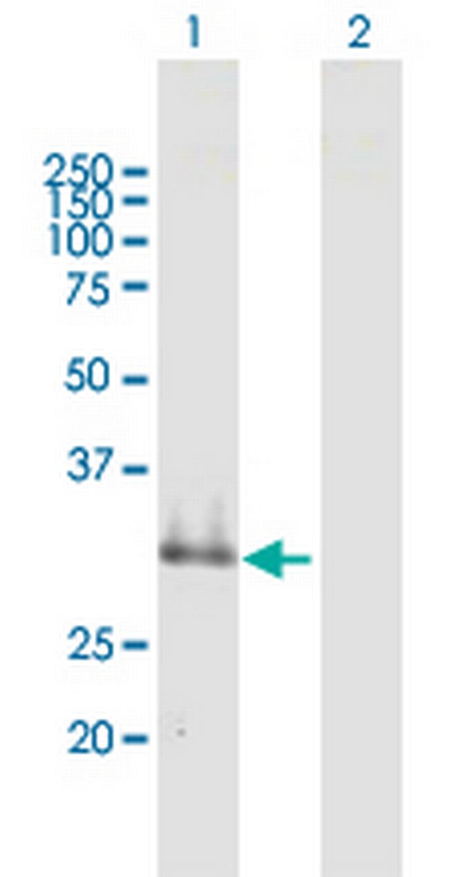 SUSD4 Antibody in Western Blot (WB)