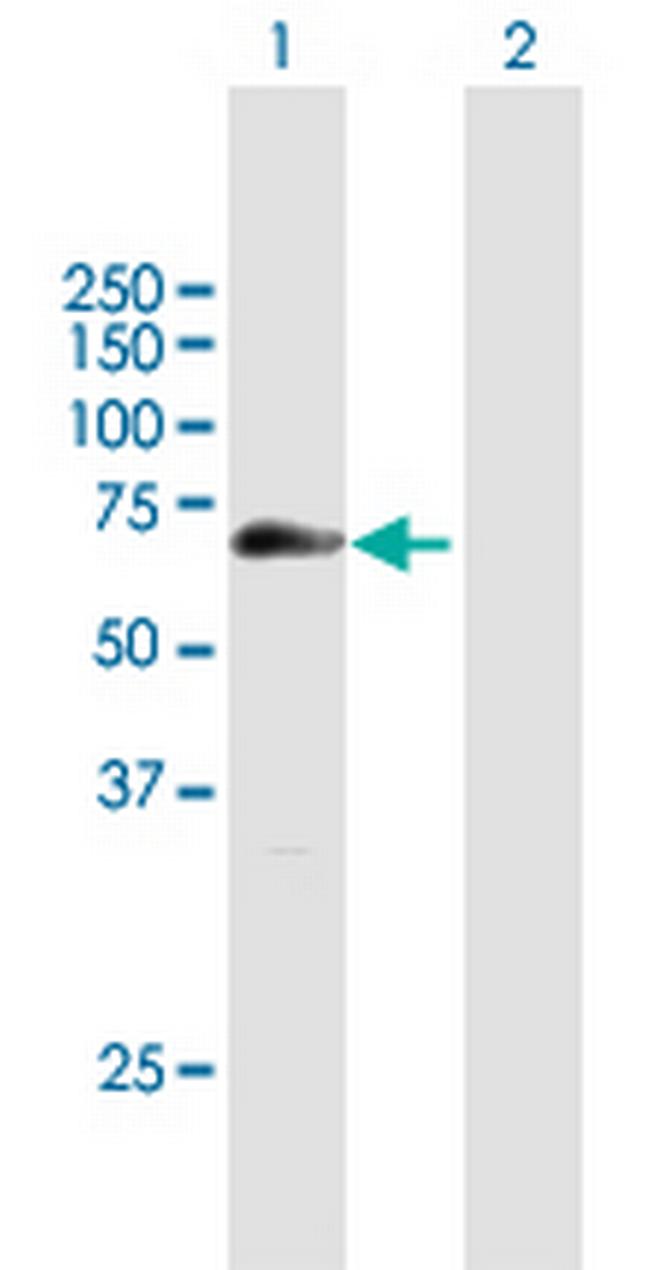 ZCWPW1 Antibody in Western Blot (WB)