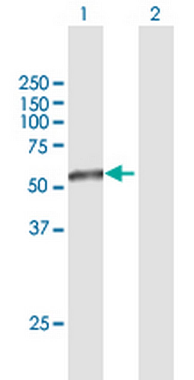 TAPBPL Antibody in Western Blot (WB)