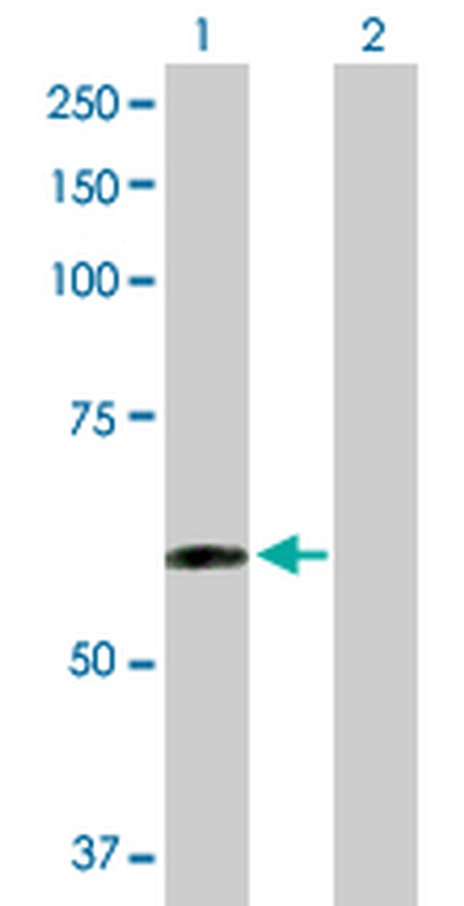 TAPBPL Antibody in Western Blot (WB)