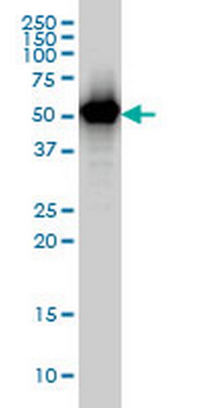 TAPBPL Antibody in Western Blot (WB)
