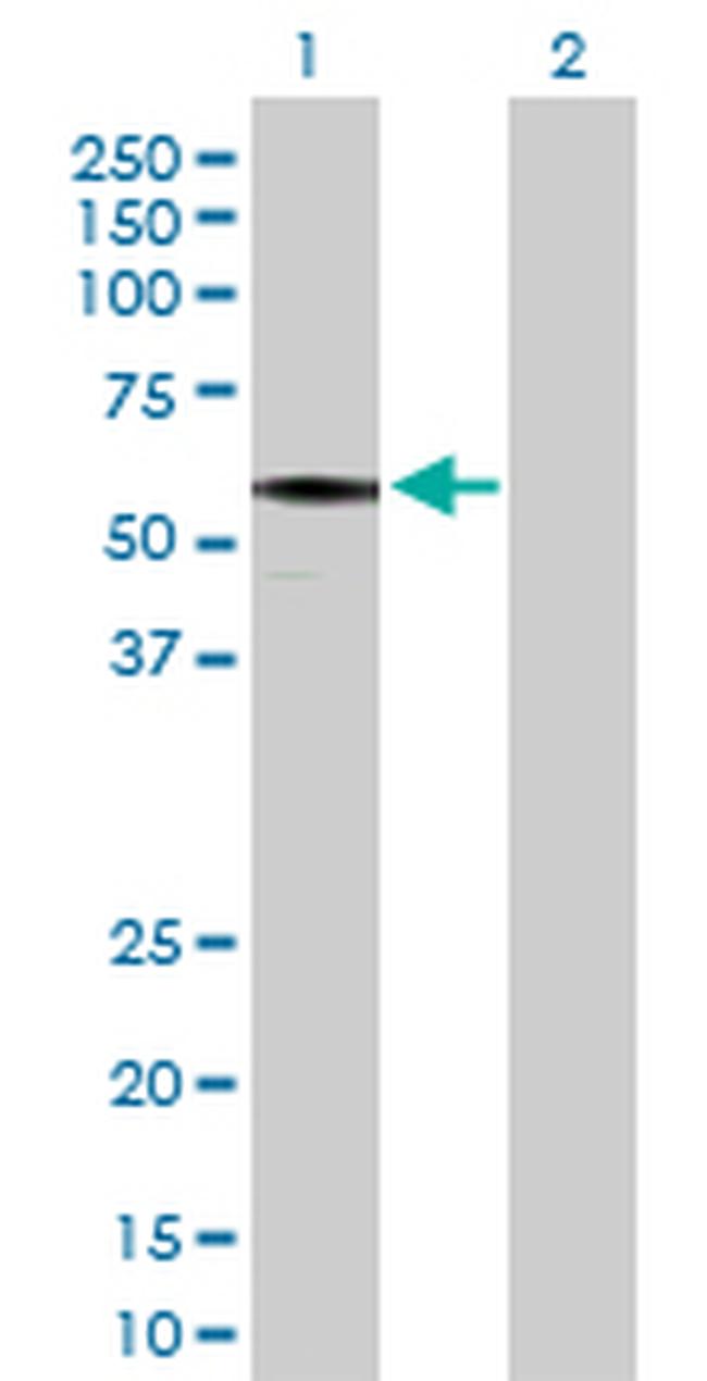 IFT57 Antibody in Western Blot (WB)