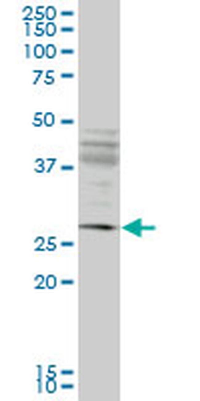 IFT57 Antibody in Western Blot (WB)