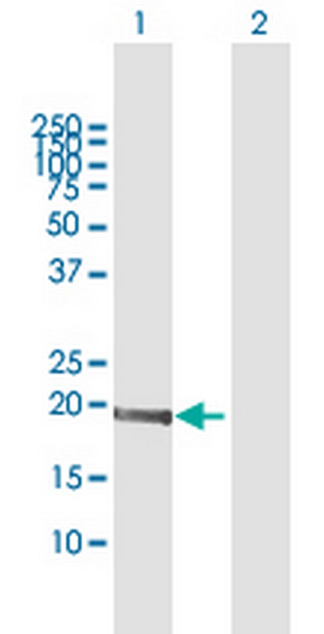 MED9 Antibody in Western Blot (WB)