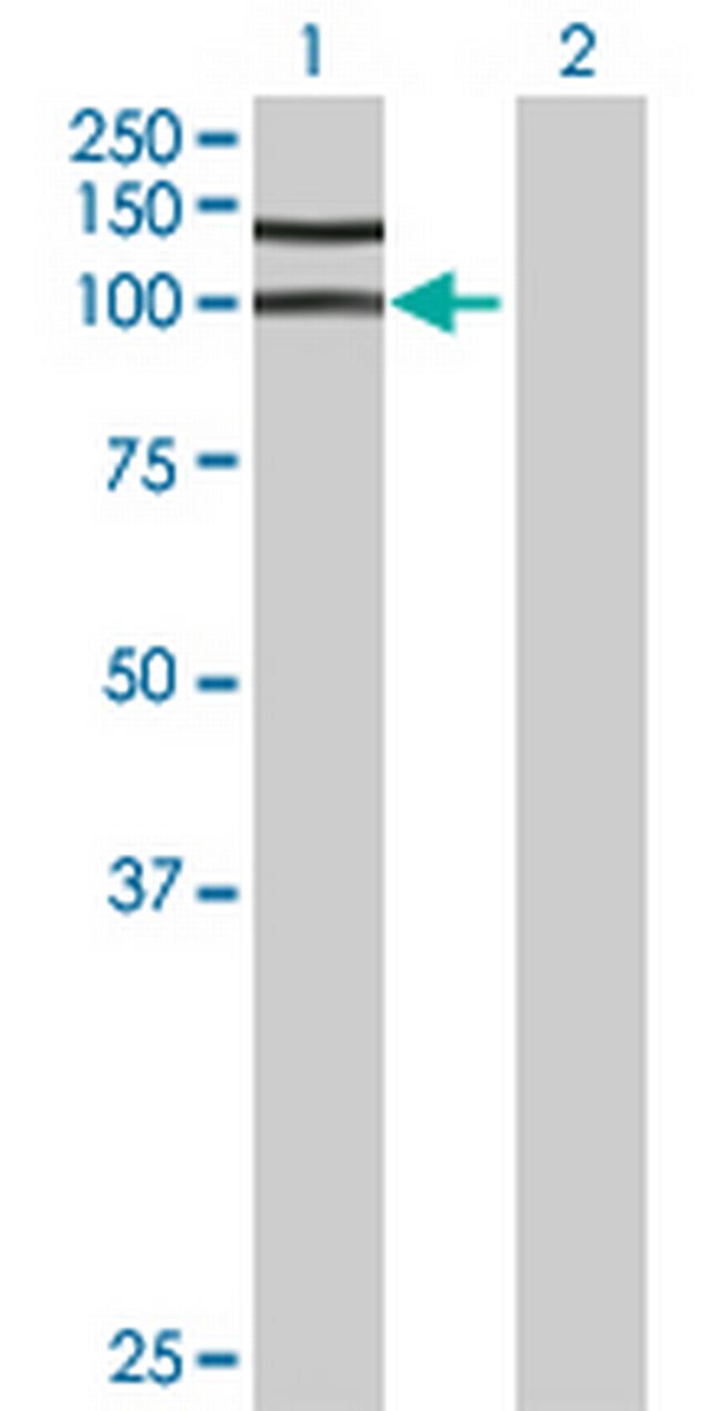 GPATC1 Antibody in Western Blot (WB)