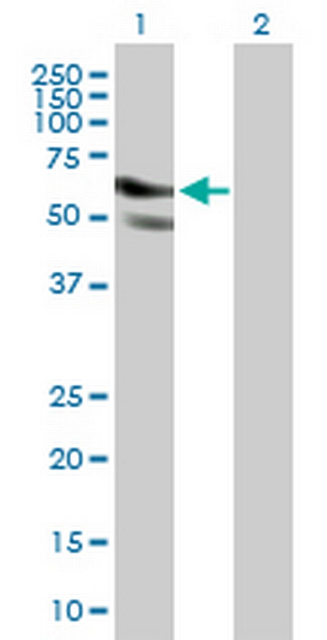 GPATCH2 Antibody in Western Blot (WB)