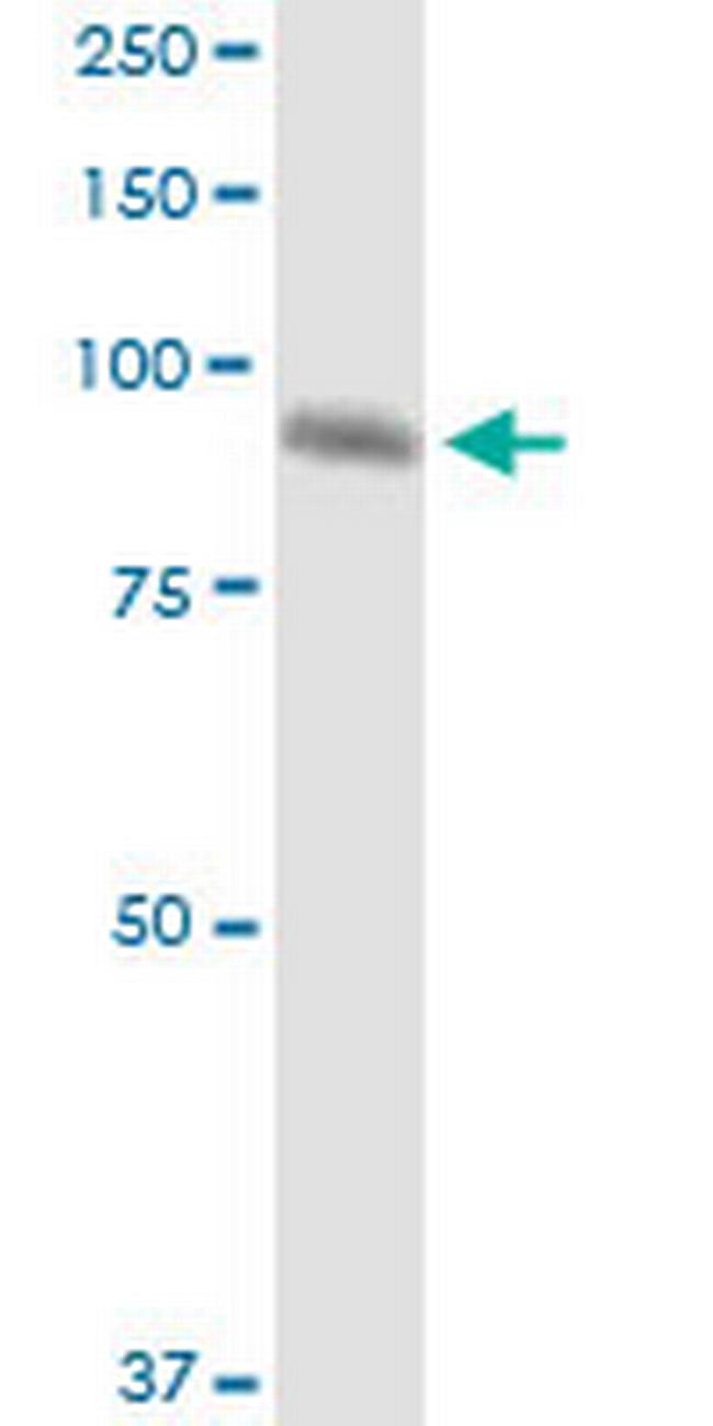 FIGN Antibody in Western Blot (WB)