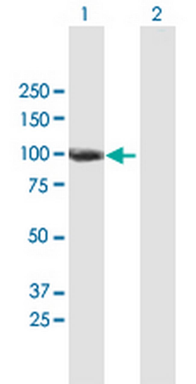 ANKZF1 Antibody in Western Blot (WB)