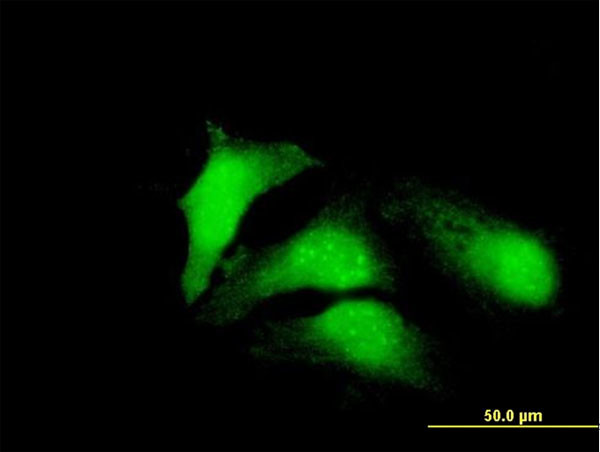 CDCA8 Antibody in Immunocytochemistry (ICC/IF)