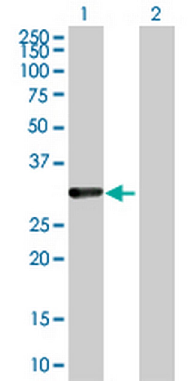 CDCA8 Antibody in Western Blot (WB)