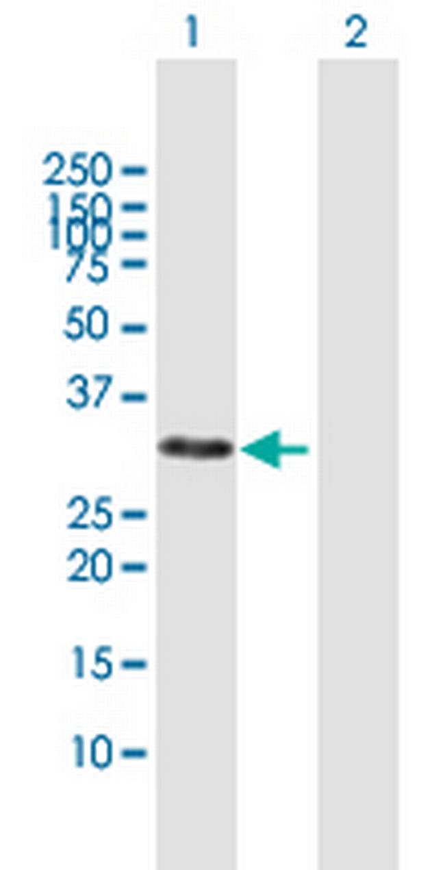 CDCA8 Antibody in Western Blot (WB)