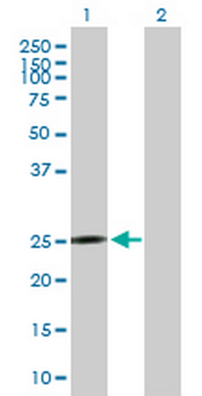 MRPS10 Antibody in Western Blot (WB)