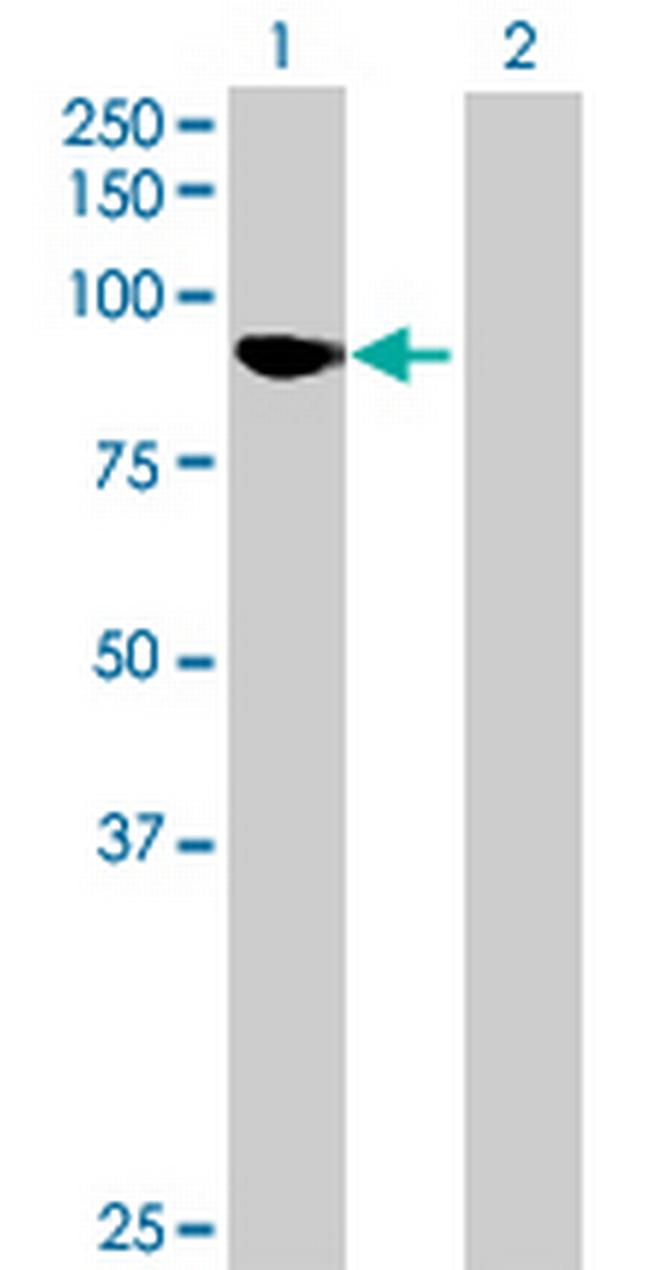 KLHL11 Antibody in Western Blot (WB)