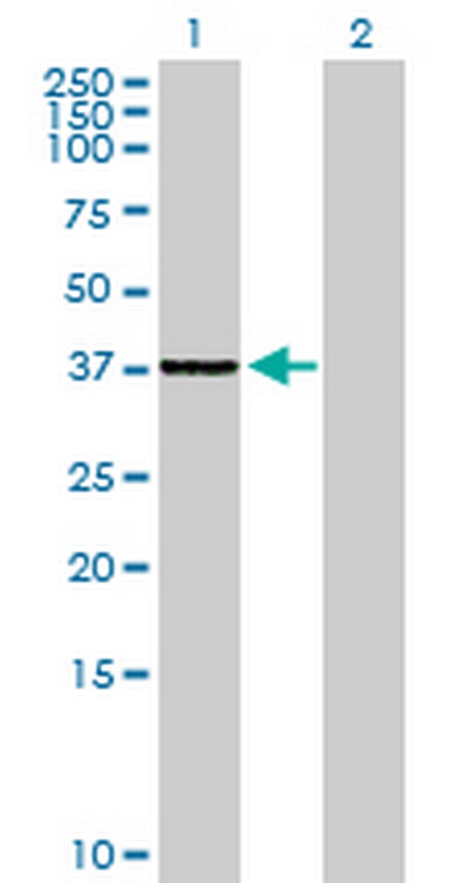 SLC25A36 Antibody in Western Blot (WB)