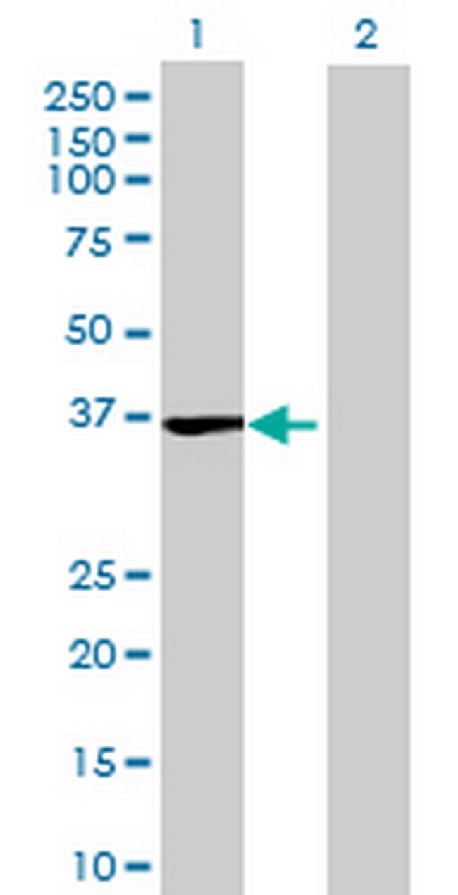 SLC25A36 Antibody in Western Blot (WB)