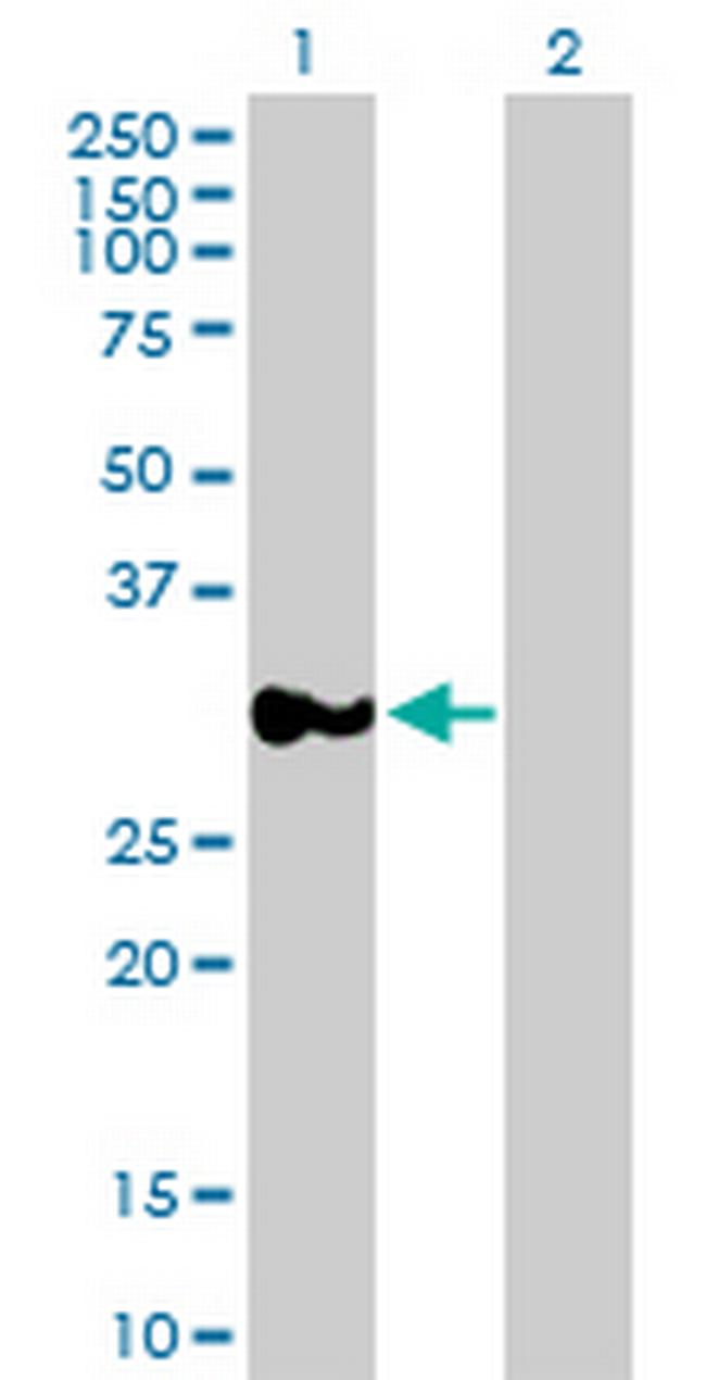 RPRD1A Antibody in Western Blot (WB)