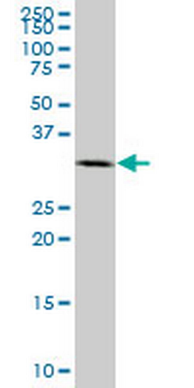 RPRD1A Antibody in Western Blot (WB)