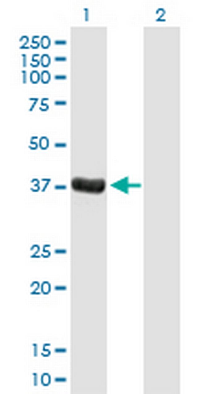 DPPA4 Antibody in Western Blot (WB)