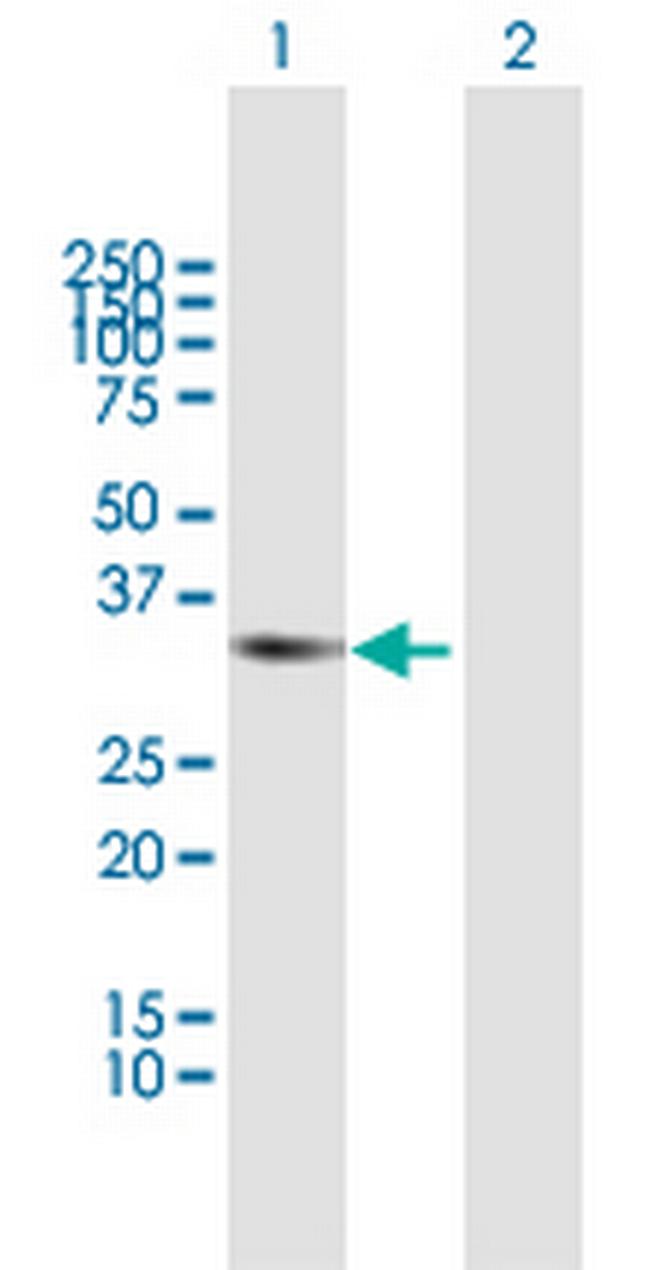RCBTB1 Antibody in Western Blot (WB)