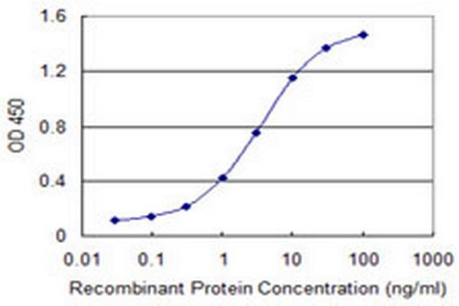 RCBTB1 Antibody in ELISA (ELISA)