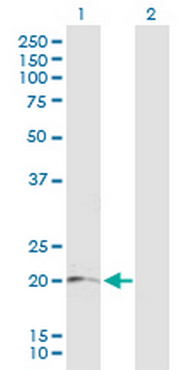 LRRC20 Antibody in Western Blot (WB)