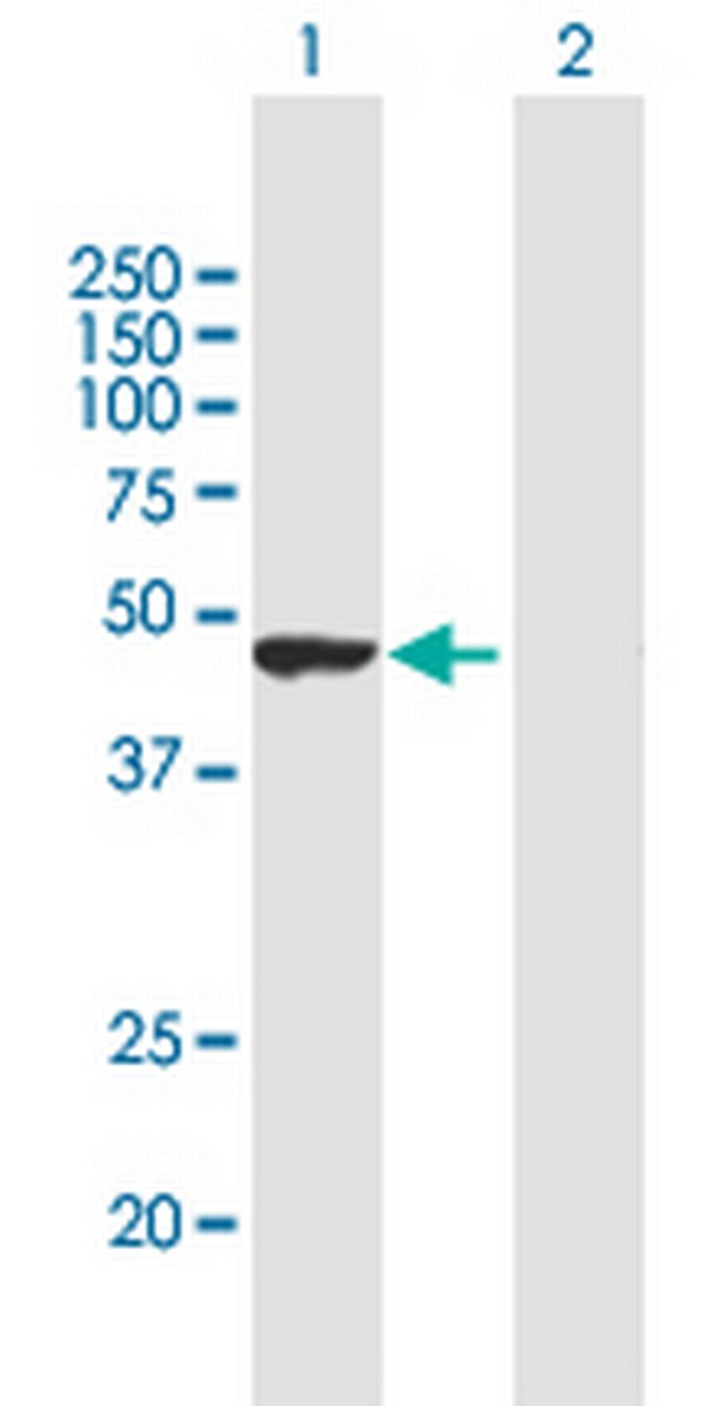 TRIM62 Antibody in Western Blot (WB)