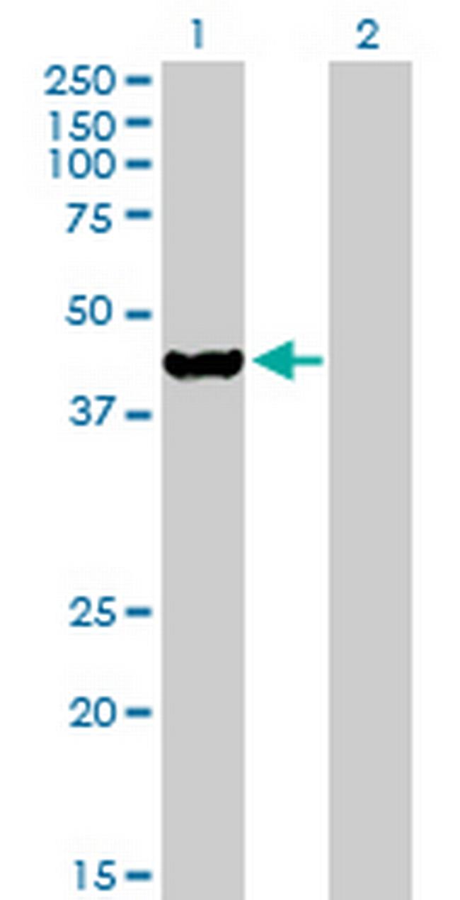 ETNK2 Antibody in Western Blot (WB)