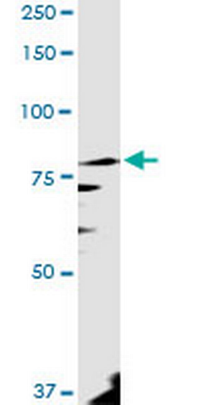 PANK4 Antibody in Western Blot (WB)
