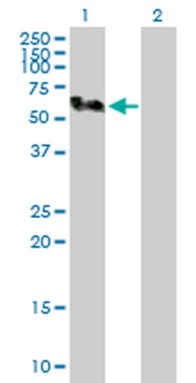 SMU1 Antibody in Western Blot (WB)