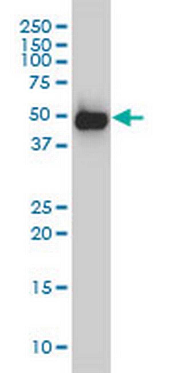 SMU1 Antibody in Western Blot (WB)