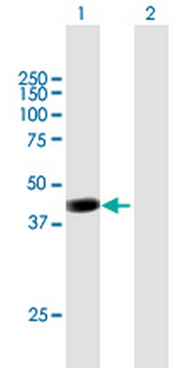 PCMTD2 Antibody in Western Blot (WB)