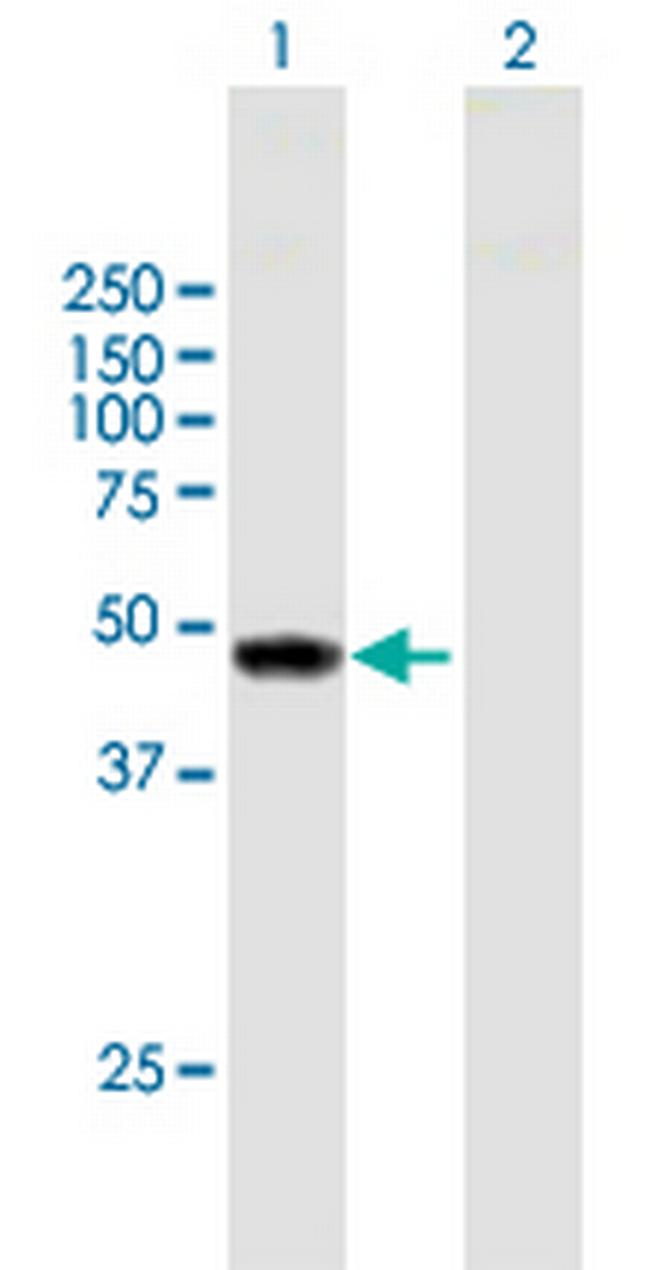 TYW1 Antibody in Western Blot (WB)