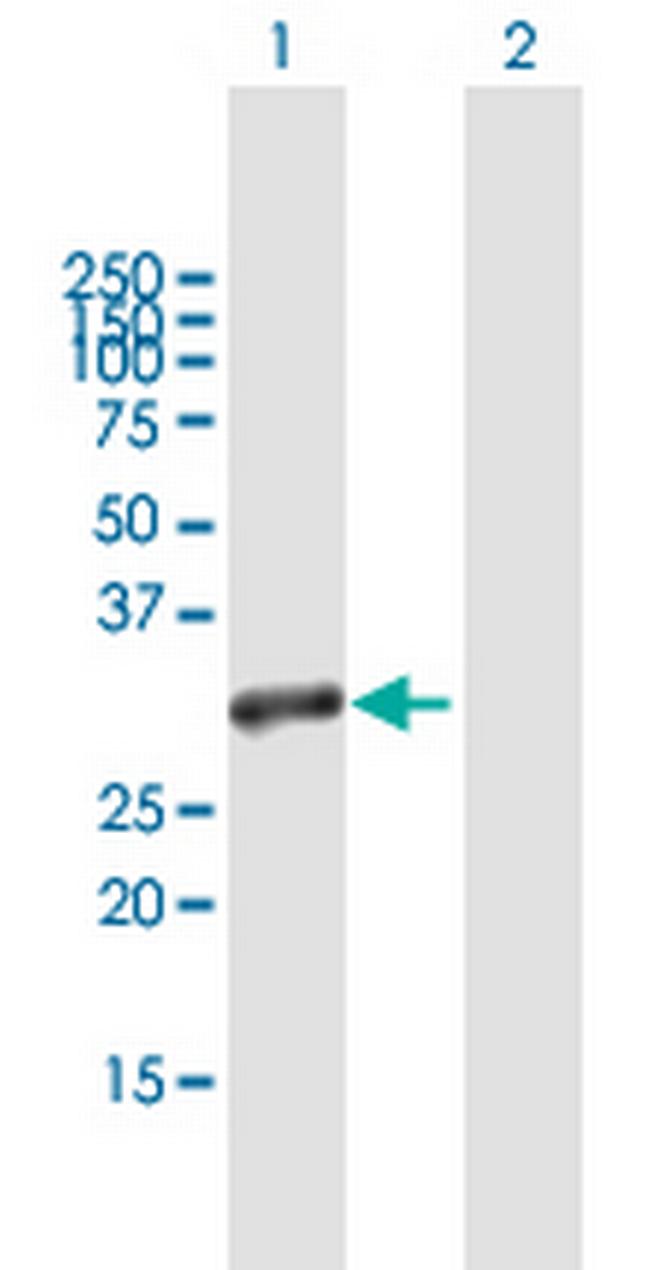 C20orf20 Antibody in Western Blot (WB)