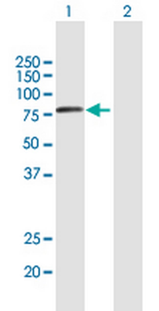 VPS53 Antibody in Western Blot (WB)