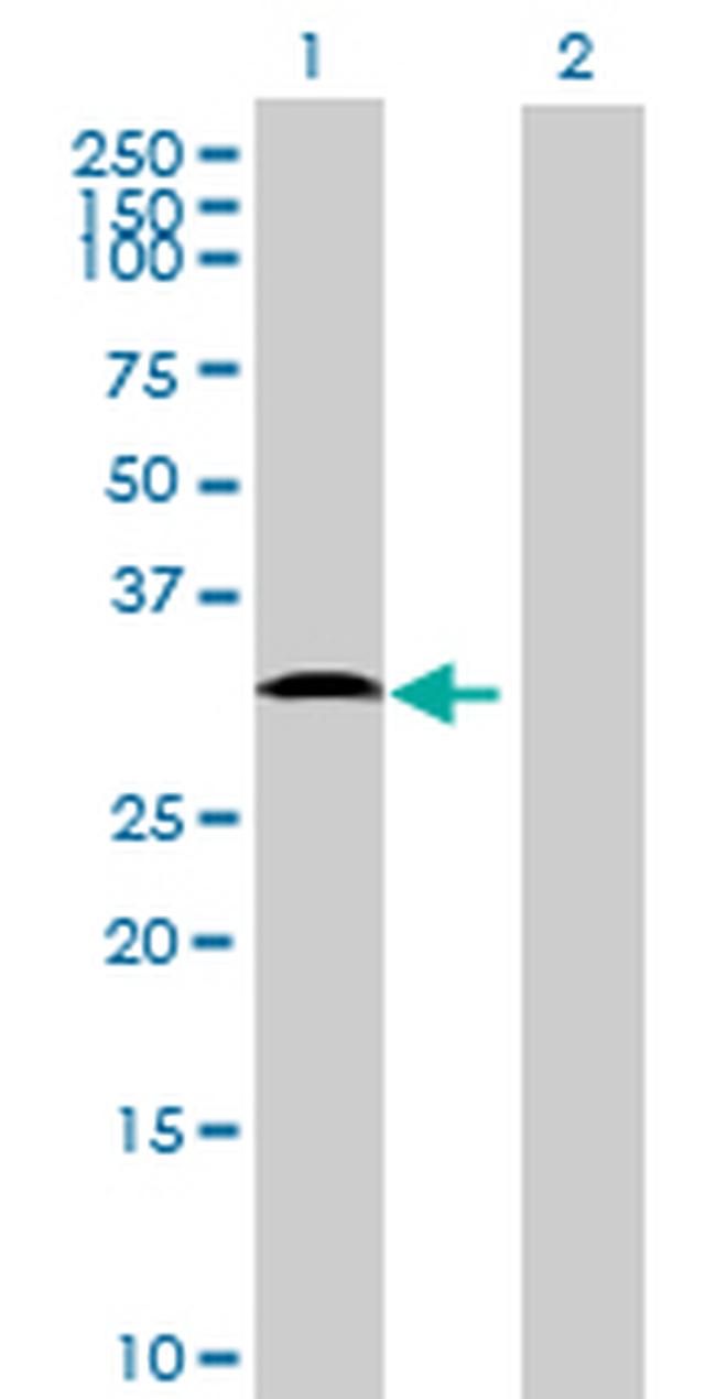 TMEM40 Antibody in Western Blot (WB)
