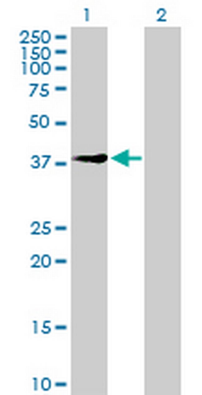 UEVLD Antibody in Western Blot (WB)