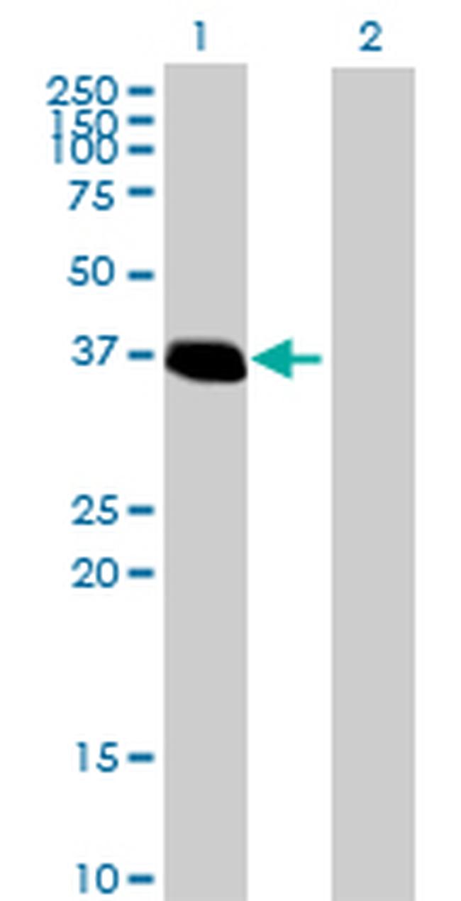 ZNF444 Antibody in Western Blot (WB)