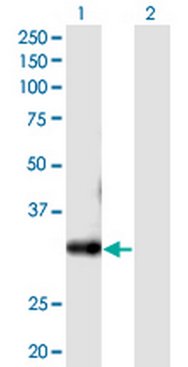 FLJ11151 Antibody in Western Blot (WB)