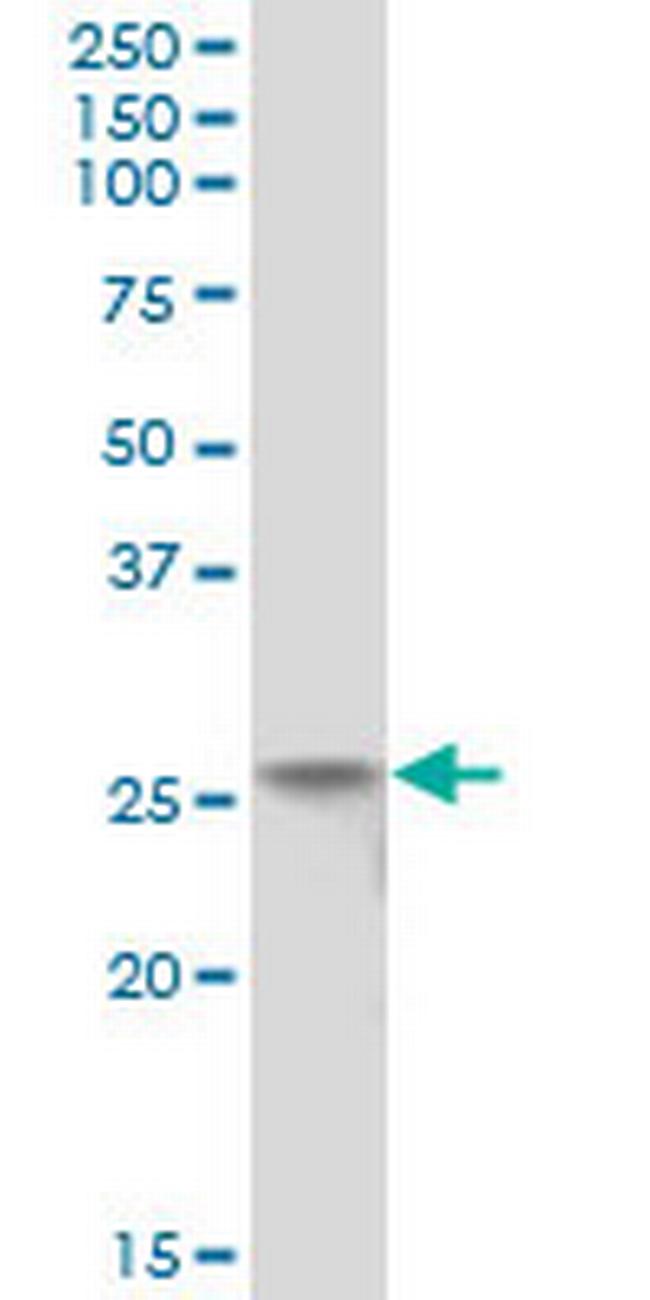 FLJ11184 Antibody in Western Blot (WB)