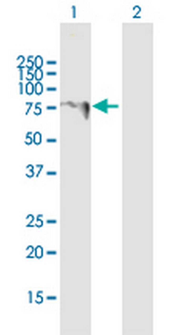 LARP6 Antibody in Western Blot (WB)