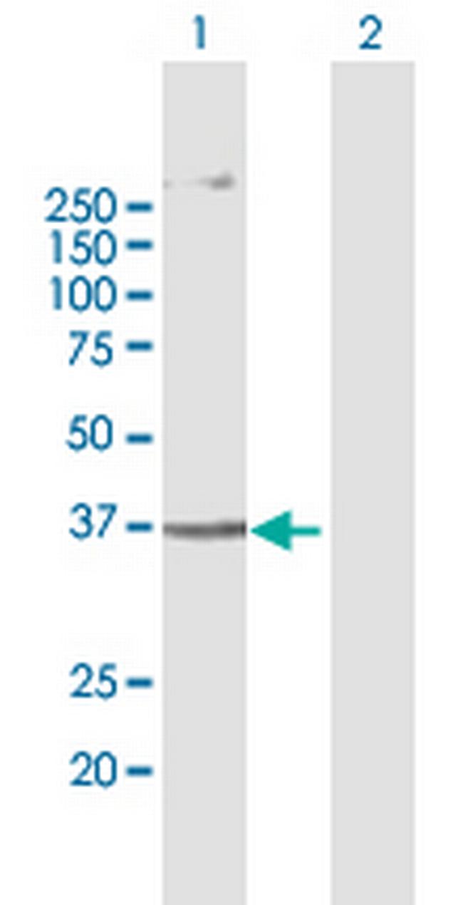 AGPAT5 Antibody in Western Blot (WB)