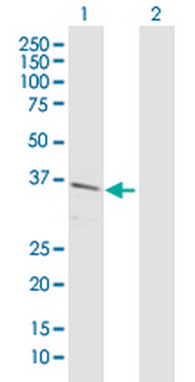 C10orf59 Antibody in Western Blot (WB)