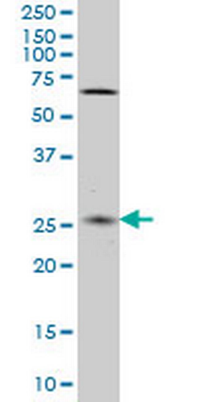 CNO Antibody in Western Blot (WB)