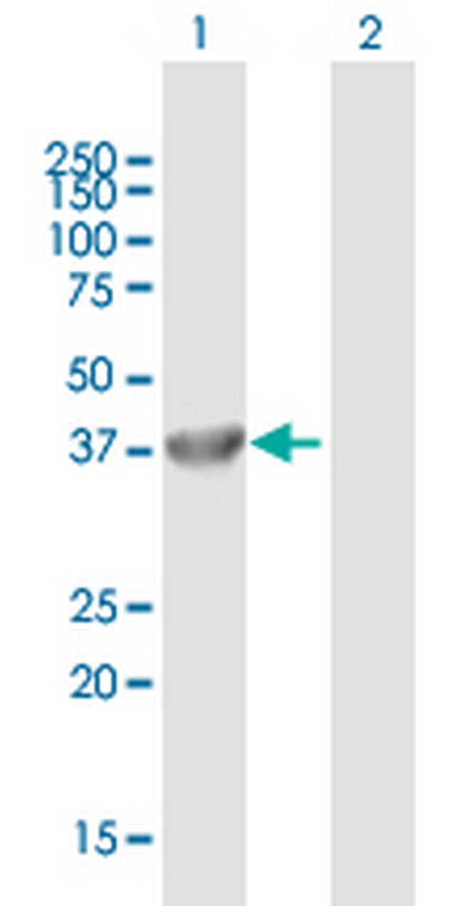 FBXL8 Antibody in Western Blot (WB)