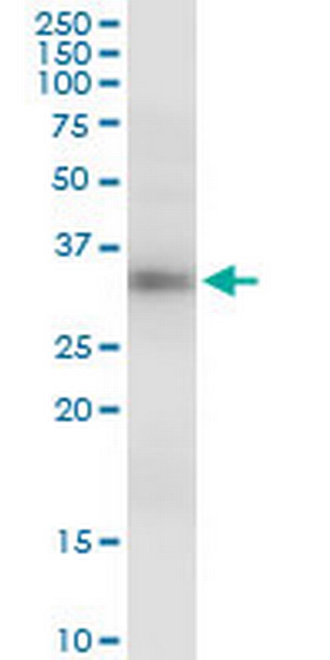 GIMAP5 Antibody in Western Blot (WB)