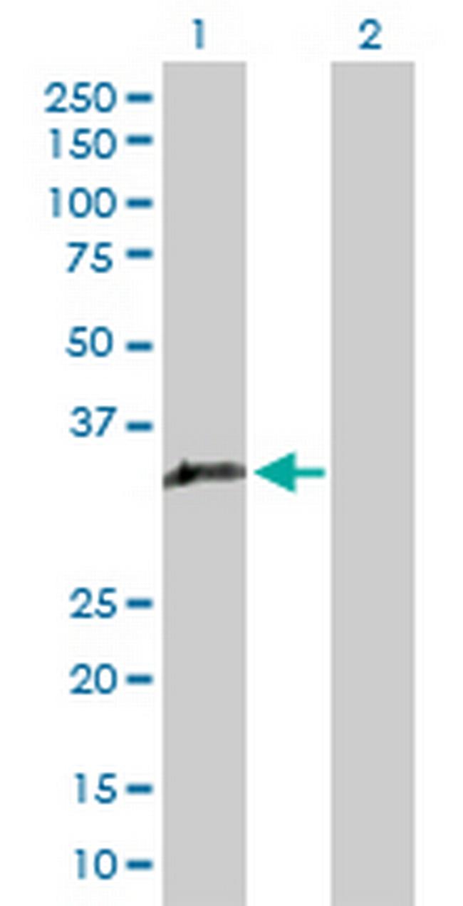 GIMAP5 Antibody in Western Blot (WB)