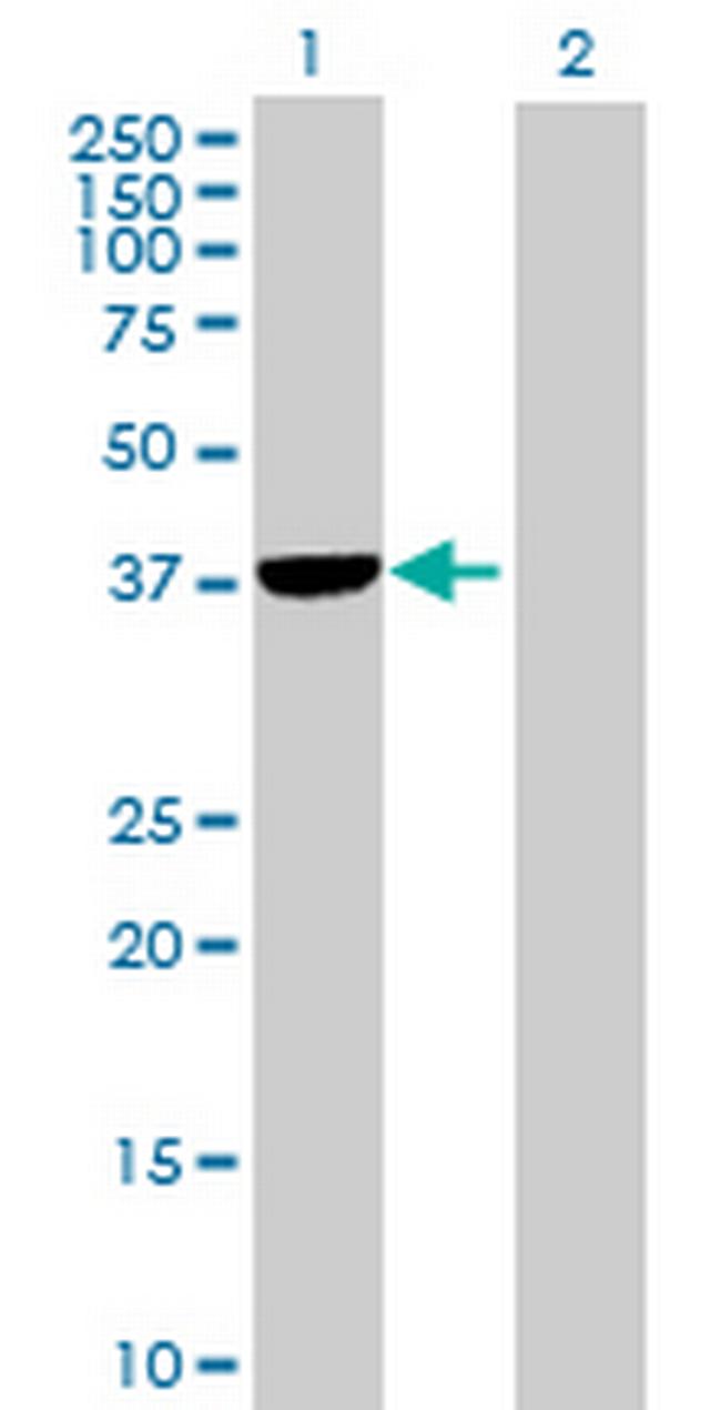 PLCXD1 Antibody in Western Blot (WB)