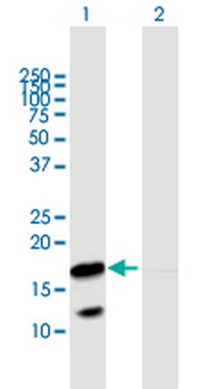 VNN3 Antibody in Western Blot (WB)
