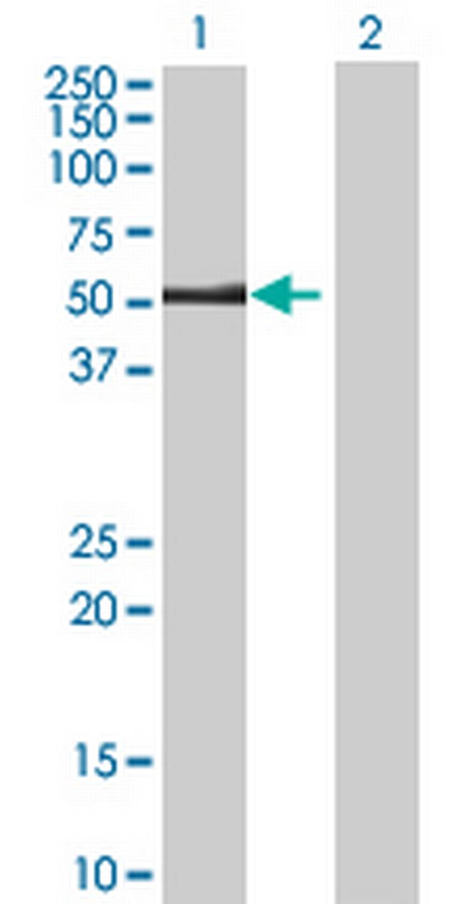 STK32B Antibody in Western Blot (WB)